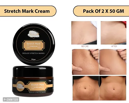 Stretch Marks Cream to Help Minimize Stretch Marks 50 g Pack of 2-thumb0