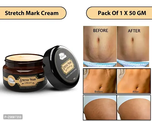 Stretch Marks Cream to Help Minimize Stretch Marks 50gm-thumb0