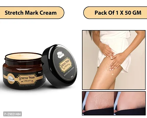 Rabenda Stretch Marks Cream to Reduce Stretch Marks  Scars (50 gm) Cream| Pack Of 1-thumb0