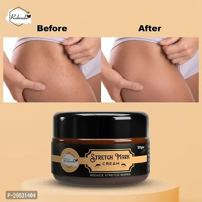 Rabenda Stretch Marks Cream to Reduce Stretch Marks  Scars (50 gm) Cream| Pack Of 1-thumb4