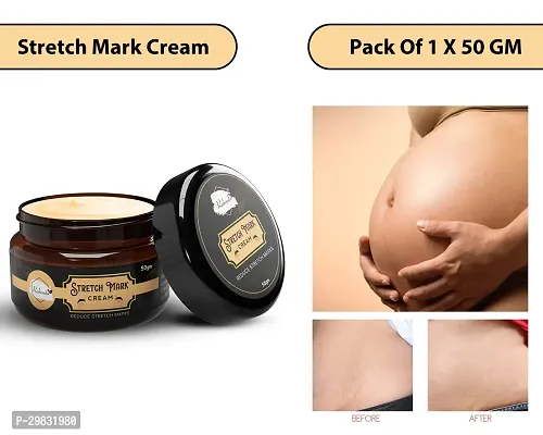 Rabenda Stretch Marks Cream to Reduce Stretch Marks  Scars (50 gm) Cream| Pack Of 1-thumb0