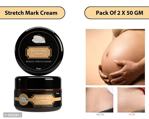 Rabenda Stretch Marks Cream to Reduce Stretch Marks  Scars (50 gm) Cream| Pack Of 2-thumb0