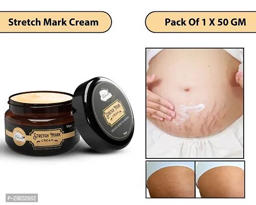 Modern Skin Stretch Marks Cream (50 gm)Pack Of 1