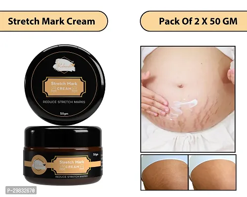 Modern Skin Stretch Marks Cream (50 gm)Pack Of 1