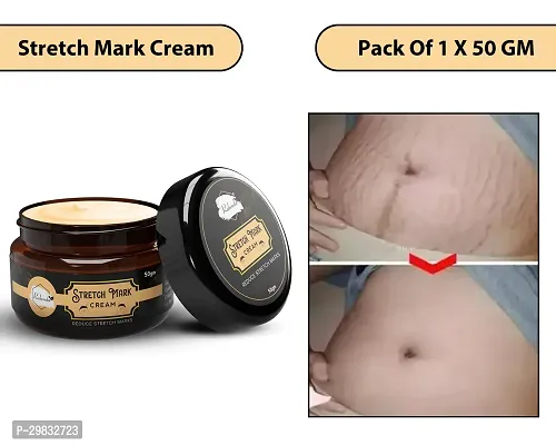 Modern Skin Stretch Marks Cream (50 gm)Pack Of 2