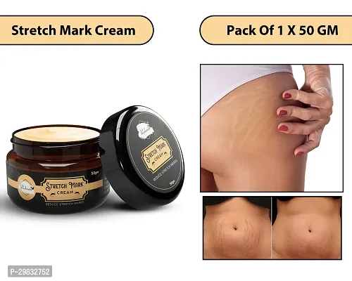 Modern Skin Stretch Marks Cream (50 gm)Pack Of 1-thumb0