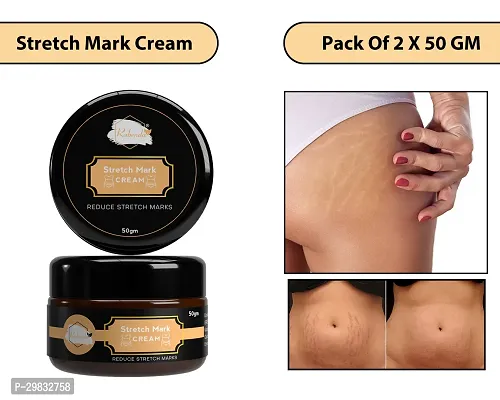 Modern Skin Stretch Marks Cream (50 gm)Pack Of 2