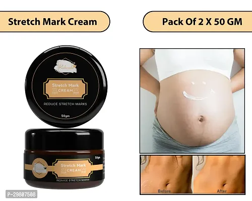 Stretch Marks Cream to Help Minimize Stretch Marks  Even Out Skin Tone (50 g) (Pack of 2)-thumb0