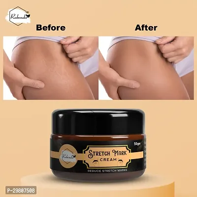 Stretch Marks Cream to Help Minimize Stretch Marks  Even Out Skin Tone (50 g) (Pack of 2)-thumb2