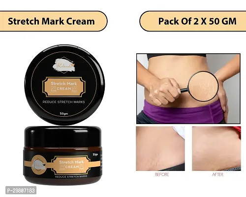 Stretch Marks Cream to Help Minimize Stretch Marks  Even Out Skin Tone (50 g) (Pack of 2)