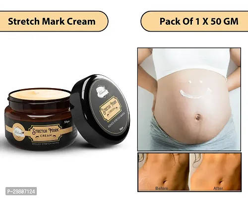 Stretch Marks Cream to Help Minimize Stretch Marks  Even Out Skin Tone (50 g) (Pack of 1)