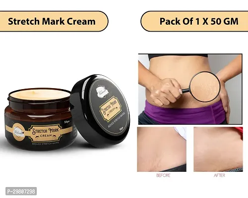 Stretch Marks Cream to Help Minimize Stretch Marks  Even Out Skin Tone (50 g) (Pack of 1)