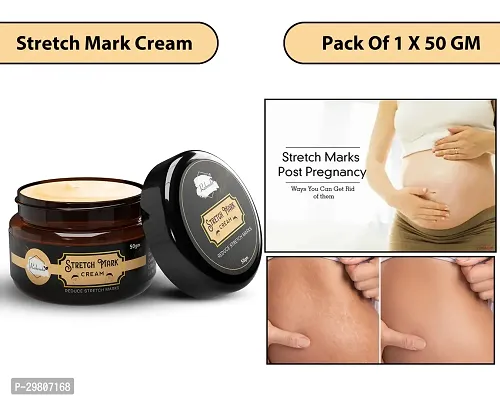 Stretch Marks Cream to Help Minimize Stretch Marks  Even Out Skin Tone (50 g) (Pack of 1)-thumb0