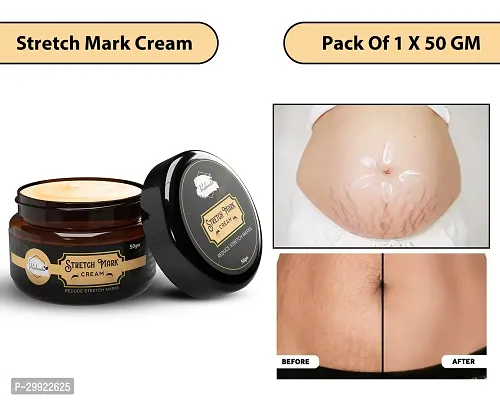 Stretch Marks Cream to Help Minimize Stretch Marks  Even Out Skin Tone (50 g) (Pack of 1)-thumb0