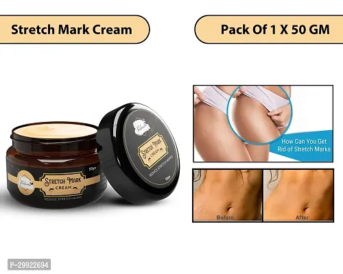 Stretch Marks Cream to Help Minimize Stretch Marks  Even Out Skin Tone (50 g) (Pack of 1)