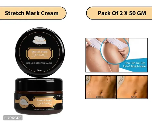 Stretch Marks Cream to Help Minimize Stretch Marks  Even Out Skin Tone (50 g) (Pack of 2)-thumb0