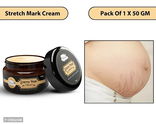 Minimize Stretch Marks Cream, 50ml-thumb0