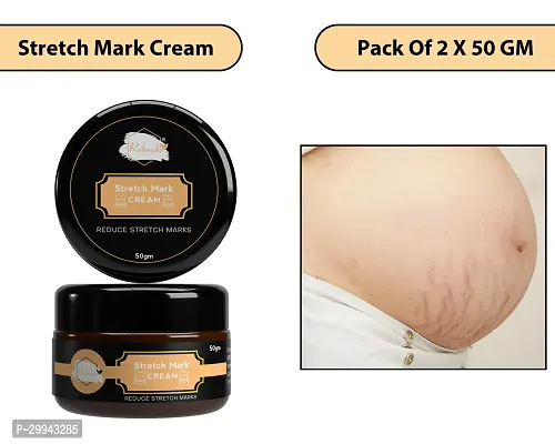 Minimize Stretch Marks Cream, 50gm