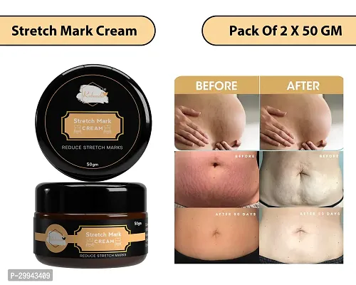 Minimize Stretch Marks Cream, 50gm