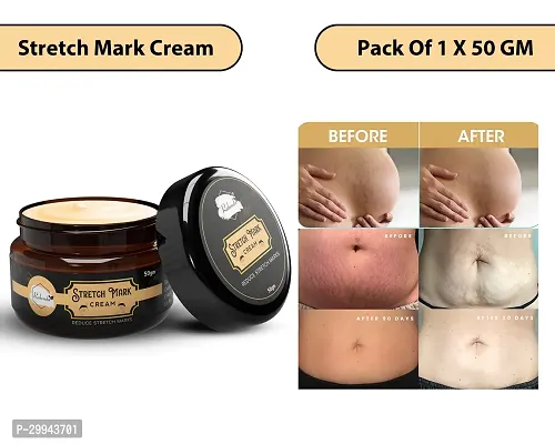 Minimize Stretch Marks Cream, 50gm