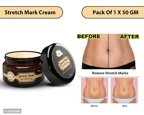 Minimize Stretch Marks Cream, 50gm-thumb0