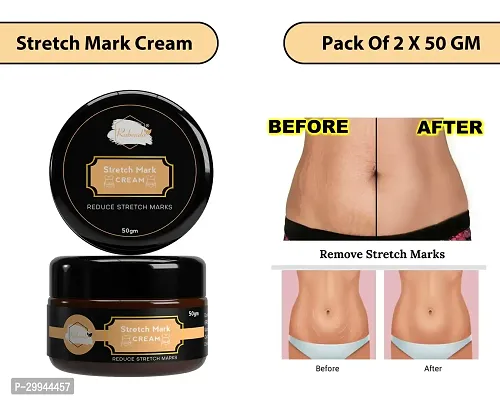 Minimize Stretch Marks Cream, 50gm-thumb0