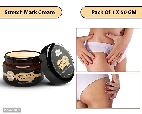 Minimize Stretch Marks Cream, 50gm-thumb0