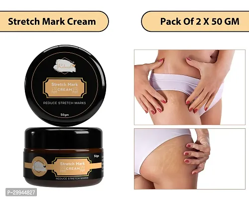 Minimize Stretch Marks Cream, 50gm