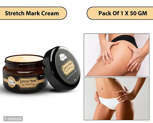 Minimize Stretch Marks Cream, 50gm-thumb0