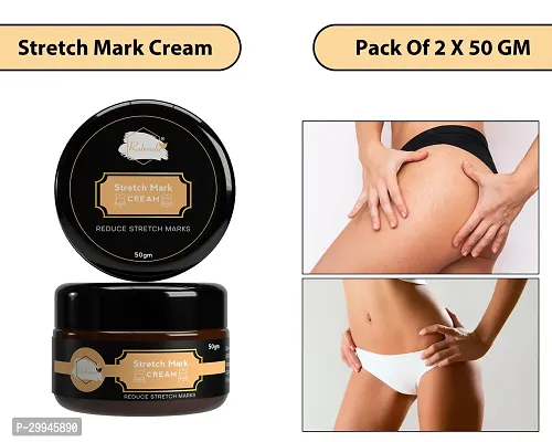 Minimize Stretch Marks Cream, 50gm