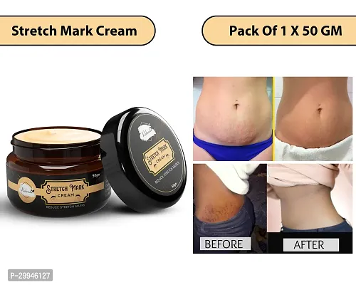 Minimize Stretch Marks Cream, 50gm-thumb0