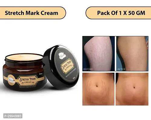 Minimize Stretch Marks Cream, 50gm-thumb0