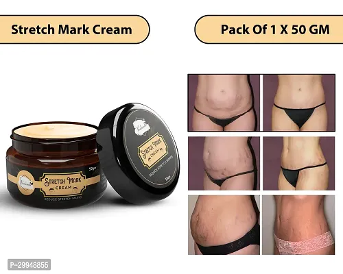 Minimize Stretch Marks Cream, 50gm-thumb0