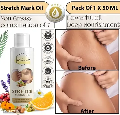 Rabenda present Repair Stretch Marks Removal - Natural Heal Mark oil 100 ml pack of 1-thumb0