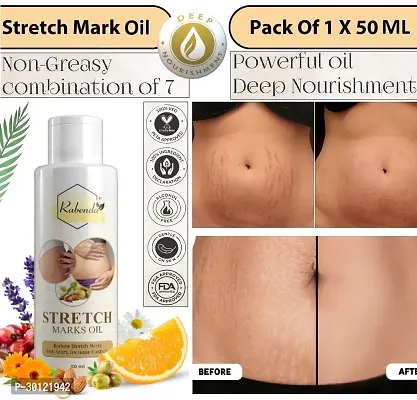 Rabenda present Repair Stretch Marks Removal - Natural Heal Pregnancy Breast, Hip, Legs, Mark oil 50 ml pack of 1