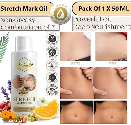 Rabenda present Repair Stretch Marks Removal - Natural Heal Pregnancy Breast, Hip, Legs, Mark oil 50 ml pack of 1