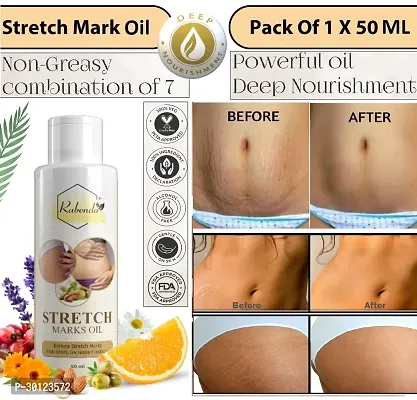 Rabenda present Repair Stretch Marks Removal - Natural Heal Pregnancy Breast, Hip, Legs, Mark oil 50 ml pack of 1