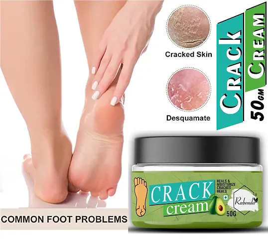 Rabenda Foot Care Cream | Feet Cream For Heel Repair | 50 Grams