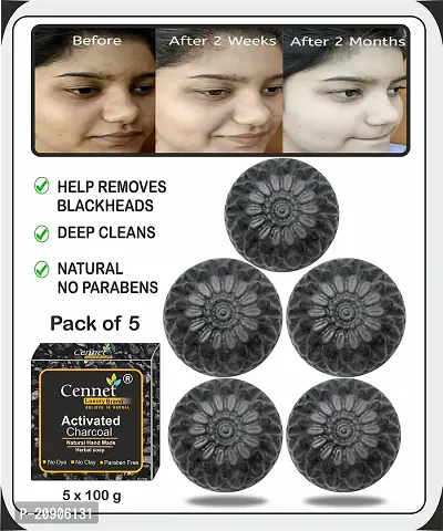 Cennet Activated charcoal soap for skin whitening, Natural Detox, Deep cleaning, Skin care soap (5x100g) pack of 5.