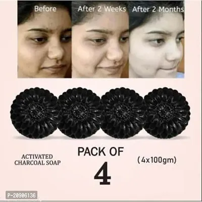 BADAHAIR?Activated Charcoal Soap for skin whitening, Blackheads, Anti Wrinkle, Pimple Skin Care Soap Treat Oily Skin Pack of 4