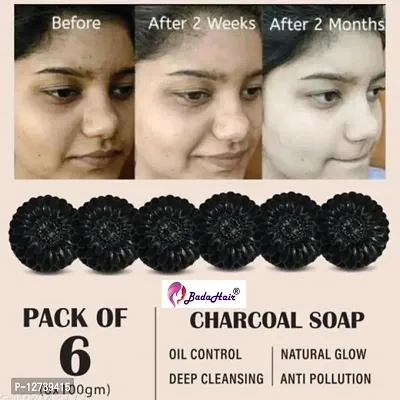Activated Charcoal Soap For Women Skin Whitening, Acne, Blackheads, Anti Wrinkle, Pimple Skin Care Soap.(Pack Of 6 )