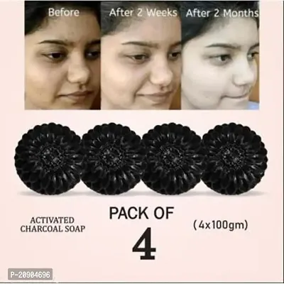 Morchito Activated Charcoal Soap For Women Skin Whitening, Acne, Blackheads, Skin Care Soap, (Pack Of 4) 4 x 100 g.-thumb0