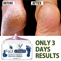 Foot Cream For Cracked Peeled Chapped Heels-thumb1