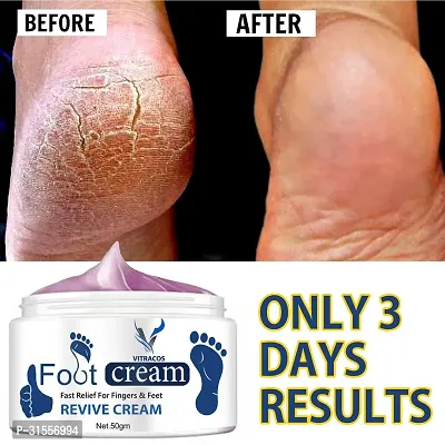 Foot Cream For Cracked Peeled Chapped Heels-thumb2