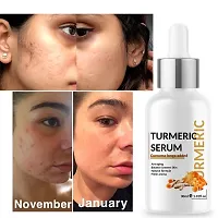 Turmeric Skin Serum 30ML-thumb4