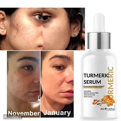 Turmeric Skin Serum 30ML-thumb5