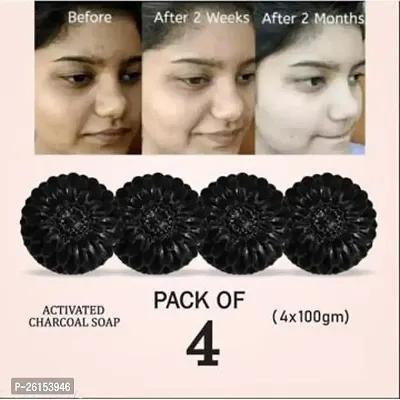 Activated Charcoal Soap For Skin Whitening, Blackheads, Anti Wrinkle, Pimple Skin Care Soap Treat Oily Skin Pack Of 4