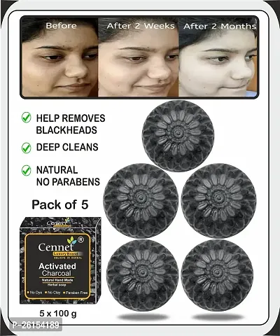 Cennet Activated Charcoal Soap For Skin Whitening, Natural Detox, Deep Cleaning, Skin Care Soap (5X100G) Pack Of 5