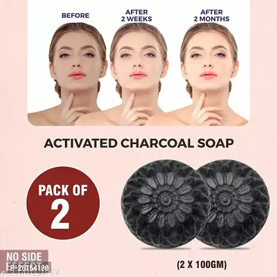 Morchito Charcoal Soap For Women Skin Whitening, With Goat Milk Base, Acne, Blackheads, Skin Care Soap (Pack Of 2) 100 X 2 Gm-thumb0