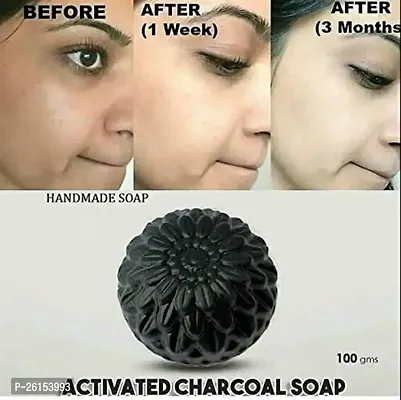 Fenotic Activated Charcoal Anti Wrinkle Soap-1